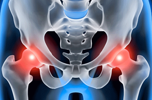 股関節の仕組みや疾患の特徴、手術方法など医師が徹底解説
